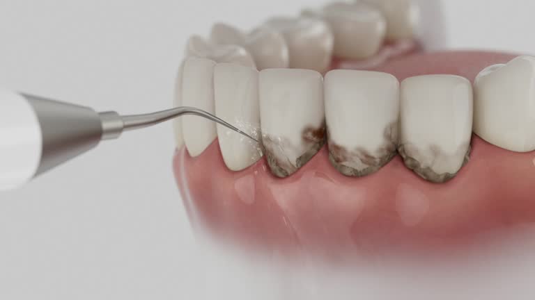 Trusted Root Canal Treatment service in Munfordville, KY - Dentist Open Now